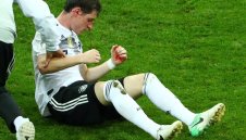 Оперираха счупения нос на Руди