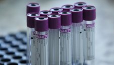 Тъжно: Още 10 нови сулчаи на коронавирус, 72-годишен почина в Силистра