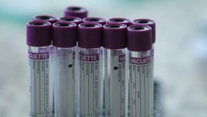 Още 10 нови случая на COVID-19 в България