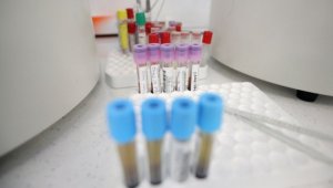 Висок брой на починалите от коронавирус в България