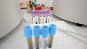 2627са потвърдените случаи на коронавирус в България