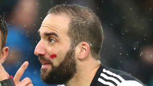 Плюят Игуаин в САЩ: За*би го този жалкар!