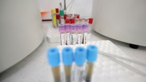 Нов черен рекорд на заразените с коронавирус в България