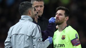 Меси е с хематом след тежкия удар от Смолинг, аут е за мача с Уеска