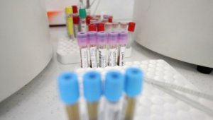 4,5% положителни за коронавирус, 627 излекувани, 24 починали