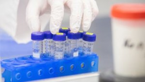81 са новите случаи на коронавирус у нас