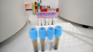 11 049 са новите случаи на коронавирус