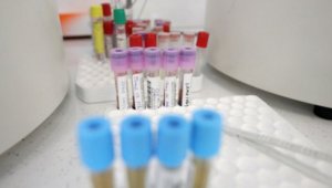 Лошо: 160 нови случая на коронавирус, починаха 12 души