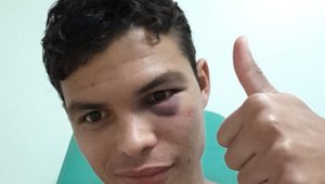 Бербатов посини окото на Тиаго Силва