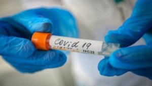 Само 1,78% от тестваните са с коронавирус