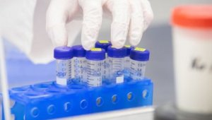 Намалява броят на случаите с коронавирус в България