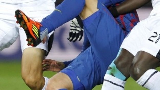 Шок! Давид Вия със счупен крак + ВИДЕО