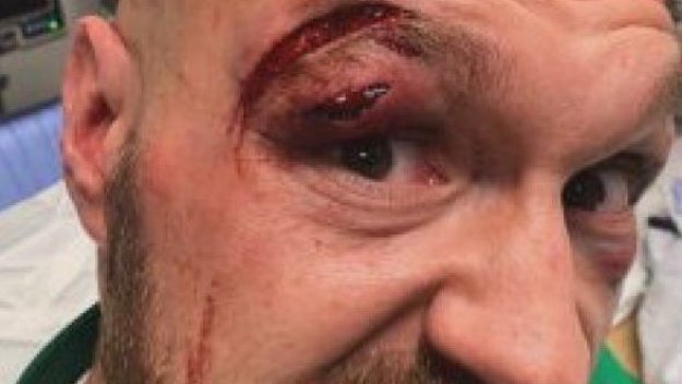 Битката на века: Има ли опасност аркадата на Фюри да го провали срещу Усик?