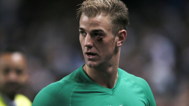 ПРОГНОЗА: Блекбърн - Манчестър Сити