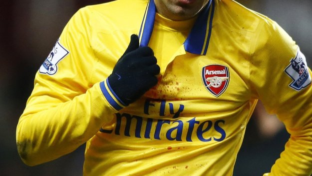 Томаш Росицки със счупен нос