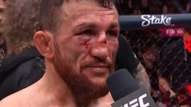 Здрав бой: Вижте как изглежда Мераб след боя от Пьотр Ян