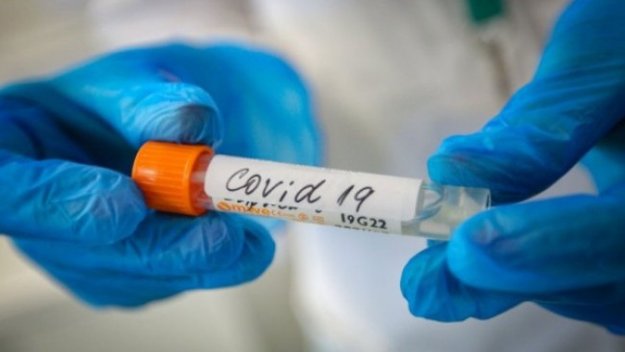 Коронавирус: 195 нови случая, седем души са починали