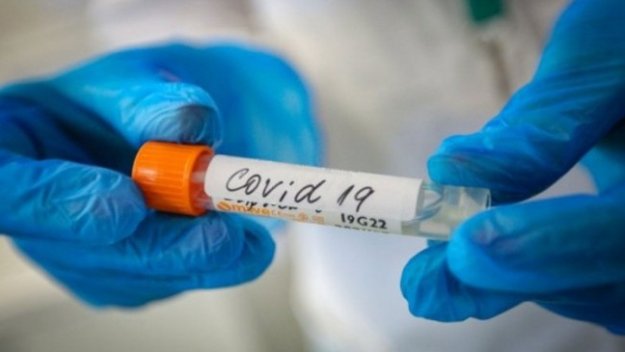 Лошо: Още 116 заразени с коронавирус, 12 души са починали