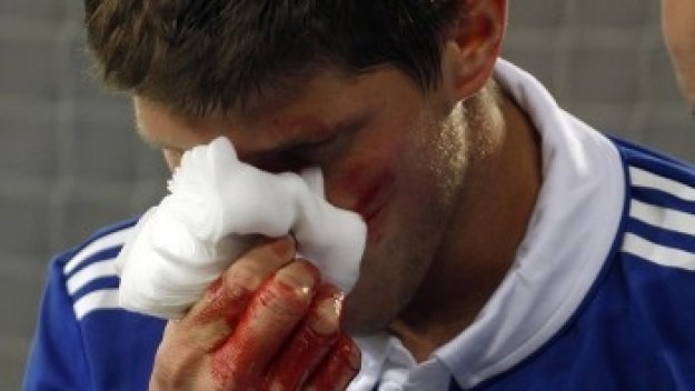 Хунтелаар на операция за счупен нос