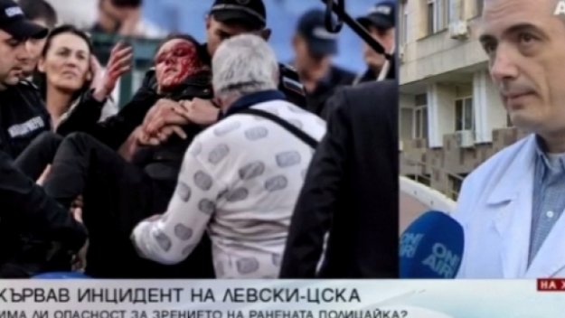 Полицията арестува хулигана, който рани с бомбичка полицайка по време на ЦСКА - Левски